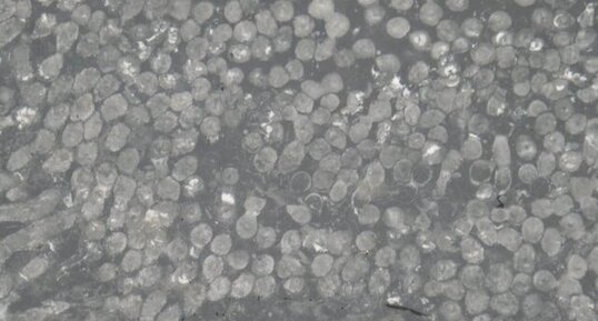 Coraux coloniaux branchus du Carbonifère du Burren